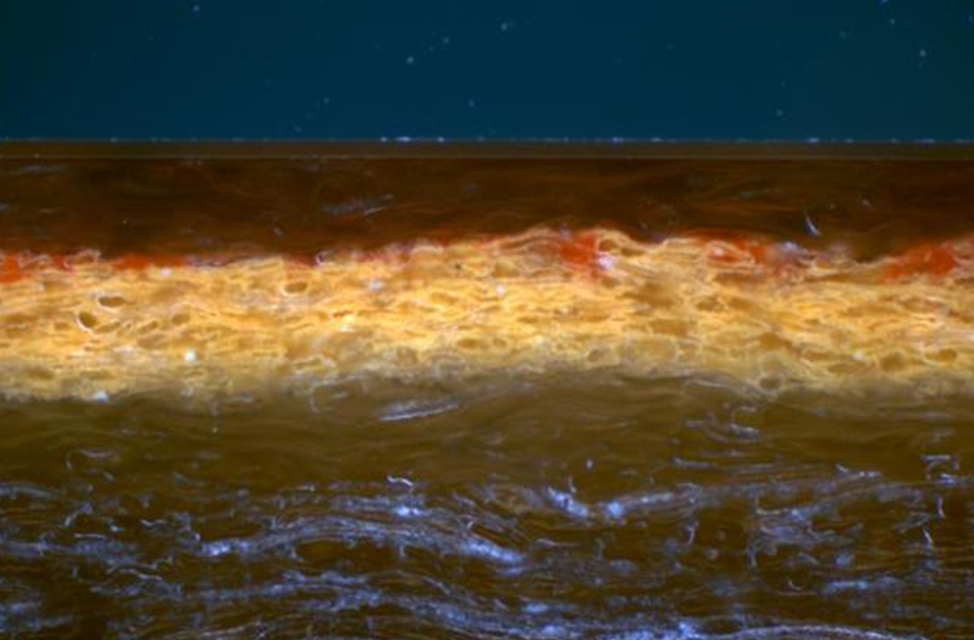 Contrasting technique Darkfield plastic layers