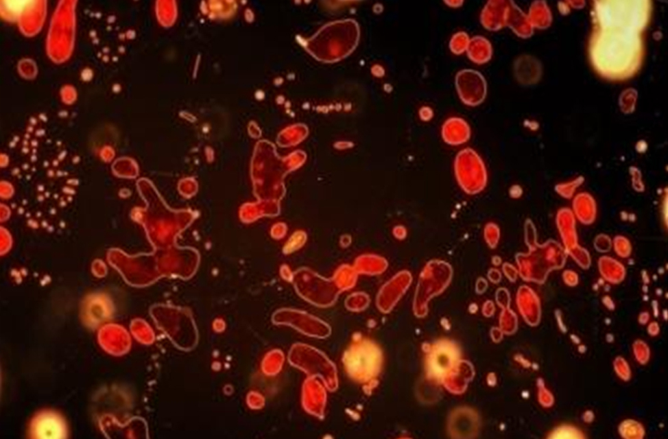 Microscopy DarkField Semi Opaque phases